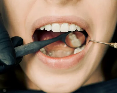 Dental Cleanings at Hometown Dental