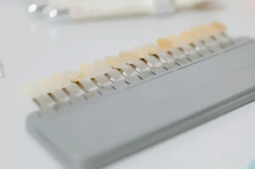 Veneers at Hometown Dental