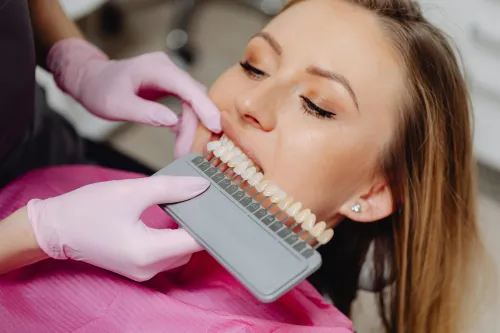 Smile Makeovers at Hometown Dental