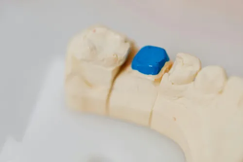 Fillings at Hometown Dental