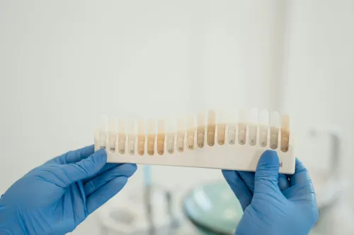 Teeth Whitening at Hometown Dental